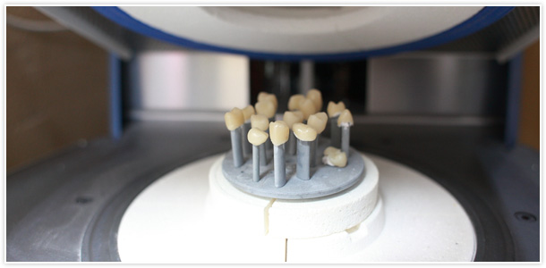 特別な治療に使用する物はすべて院内で制作しております。