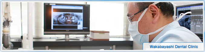 インプラント治療をご希望の患者様へ