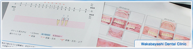 高度な歯周病治療をご希望の患者様へ